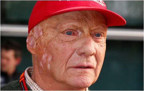 lauda-my-ne-blokiruem-vse-initsiativy